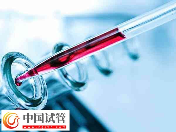 amh0.01是不是卵巢彻底衰老了!(图2) amh0.01是不是卵巢彻底衰老了!(图2)
