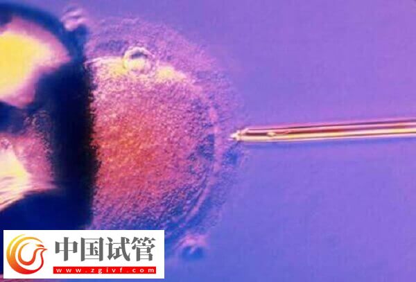 amh0.01试管有没有成功的(图2) amh0.01试管有没有成功的(图2)