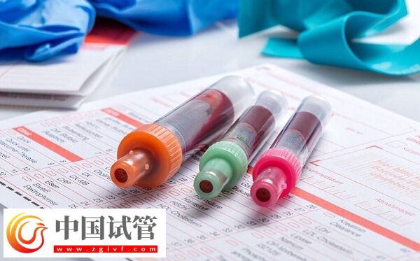 amh0.01试管有没有成功的(图1) amh0.01试管有没有成功的(图1)