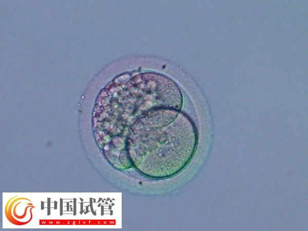 半融合胚胎成功率高不高(图2) 半融合胚胎成功率高不高(图2)