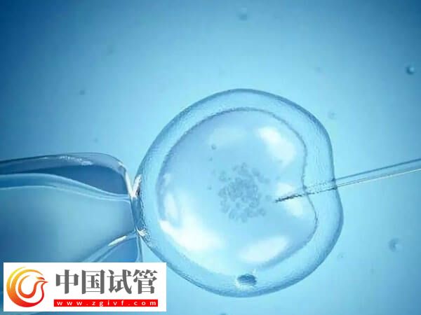 取卵后精卵不结合该怎么办(图2) 取卵后精卵不结合该怎么办(图2)