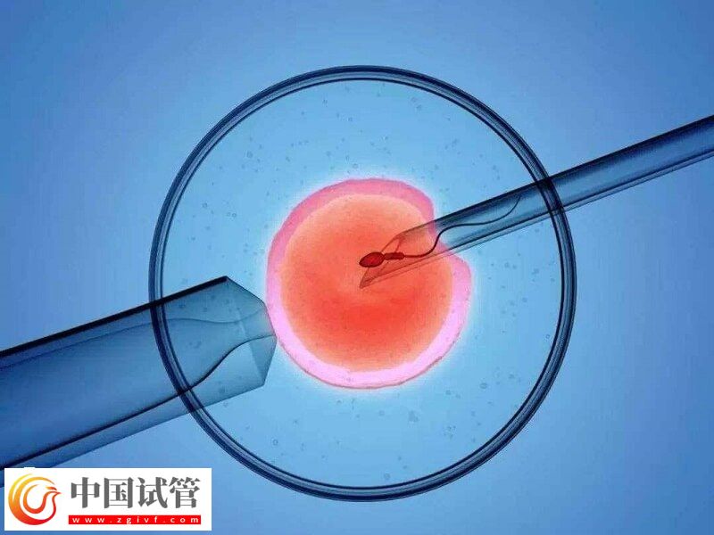 人工授精跟试管婴儿有什么区别(图1) 人工授精跟试管婴儿有什么区别(图1)