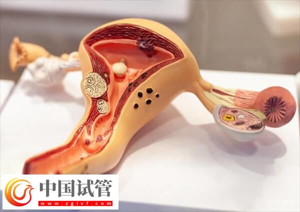 子宫肌瘤女性不能吃的食物有哪些(图1)