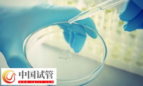 试管婴儿精液检查都有什么项目(图1)