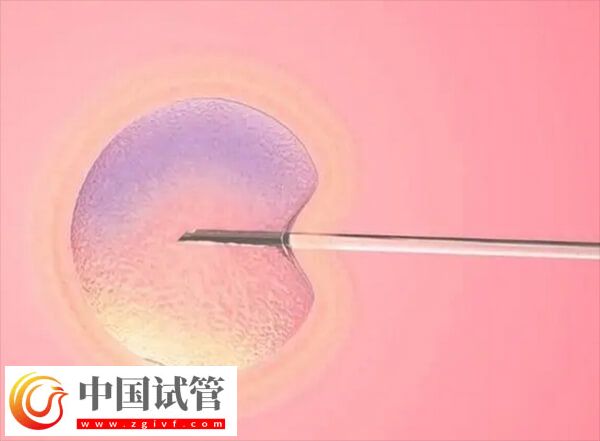 取卵同时能不能穿刺囊肿(图2)