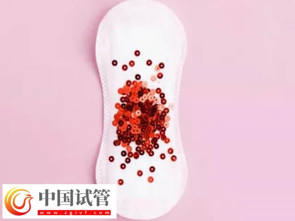 冻胚移植第11天小腹坠胀是不是失败了(图2) 冻胚移植第11天小腹坠胀是不是失败了(图2)